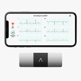 AliveCor KardiaMobile 6L Personal EKG Monitor, Black - KM-6L-E